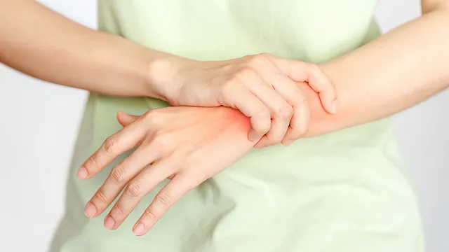 Handarthrosen
